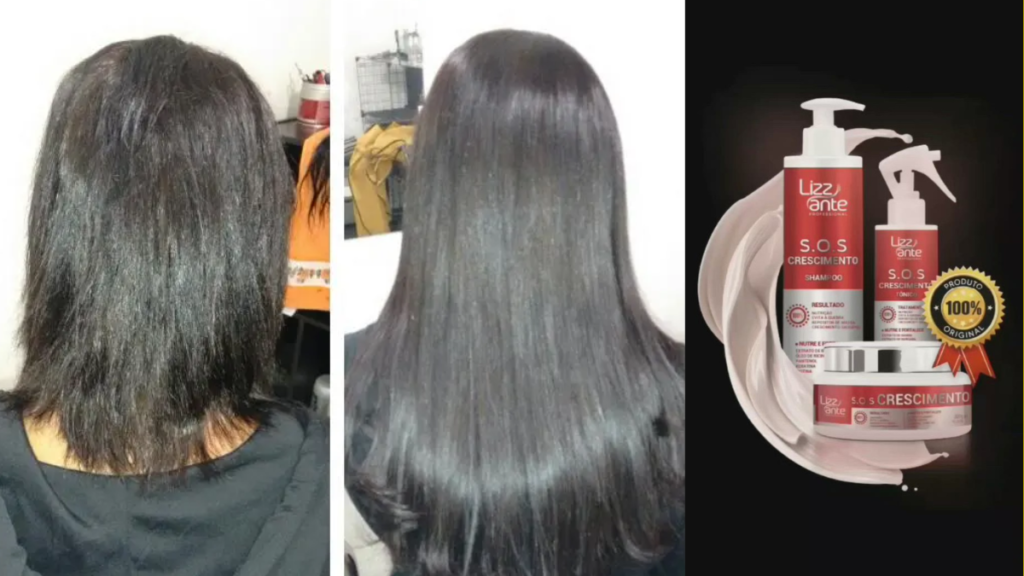 Antes e depois - Queda pós-parto recuperada com Kit S.O.S Crescimento