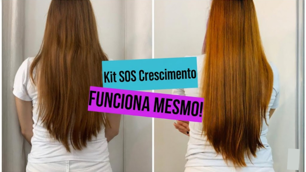Antes e depois Kit S.O.S Crescimento - Resultados em 60 dias
