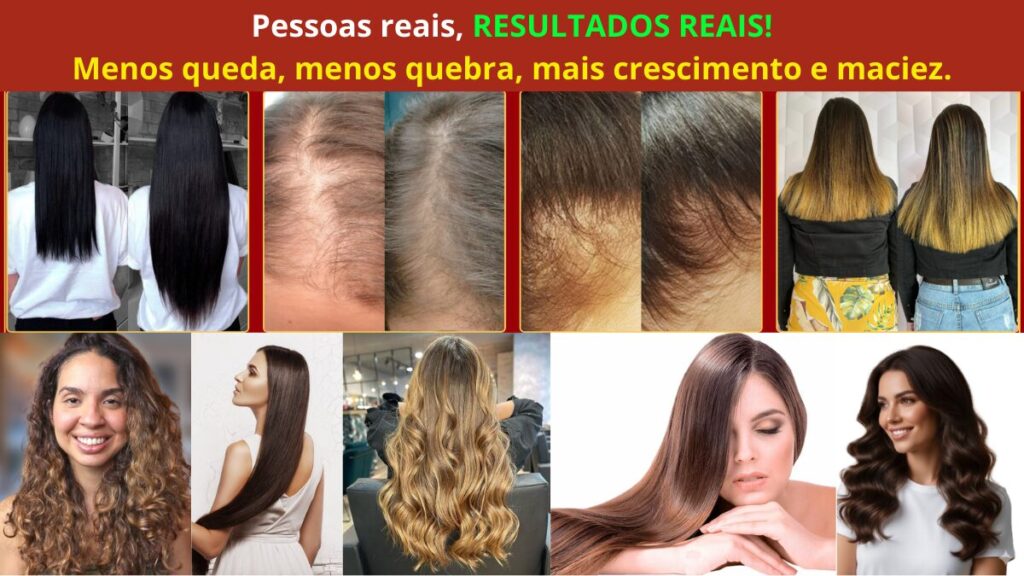 Mulheres com cabelo saudável após tratamento capilar